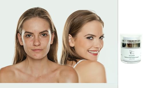 Neu Vella TimeVeil Retinol Renewal Cream-1% Retinol + HA + Niacinamide— Hydrate · Brighten · Restore —