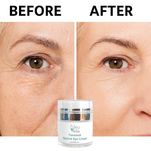 Neu Vella TimeVeil Retinol Eye Cream with Botanical Hyaluronic Acid, Niacinamide & Argan Oil – Brighten, Firm & Smooth Fine Lines – Gentle Anti-Aging Eye Treatment for Dark Circles & Puffiness – 1 oz